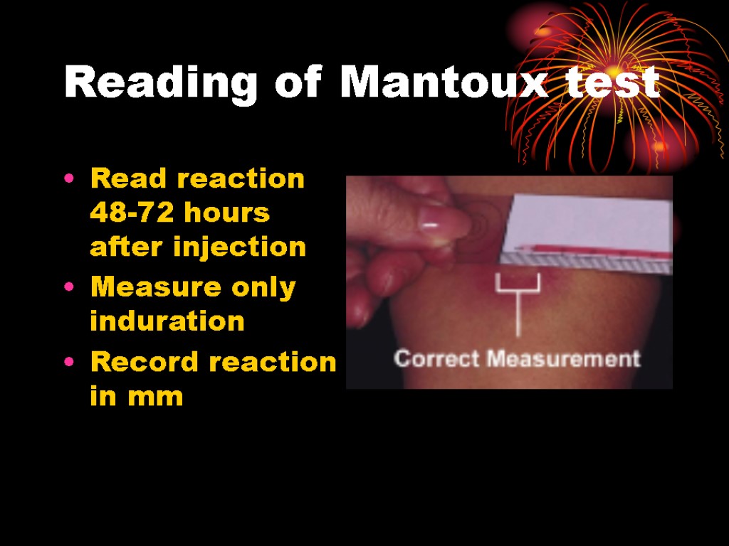 Reading of Mantoux test Read reaction 48-72 hours after injection Measure only induration Record
